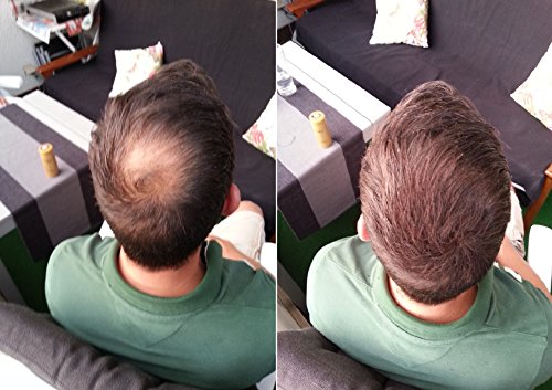 KeraFlow SCHÜTTHAAR STREUHAAR HAARVERDICHTUNG -28g- MIT SOFORTEFFEKT GEGEN TEILGLATZE UND LICHTES HAAR (DUNKELBRAUN) - 7
