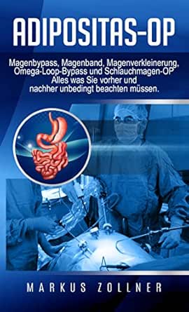 Adipositas Op Magenbypass Magenband Magenverkleinerung Omega Loop Bypass Und Schlauchmagen Op Alles Was Sie Vorher Und Nachher Unbedingt Beachten Mussen German Edition Ebook Zollner Markus Amazon In Kindle Store