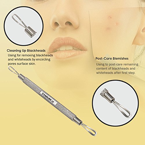 Komedonenquetscher – Mitesserentferner – Pickelentferner Set – Akne Extraktoren – 6 Stücke Edelstahl - 6