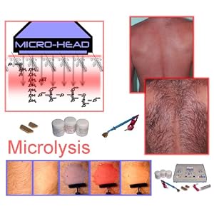 Aavexx Micro 1000 Professional Business System for Permanent Hair Removal and More. - Image 3