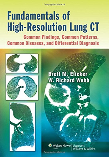 Fundamentals of High-Resolution Lung CT: Common Findings, Common Patterns, Common Diseases, and Differential Diagnosis: Common Findings, Common Patterns, Common Diseases, and Differential Diagnosis