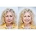 Art Harding's Instant Face And Neck Lift Refill