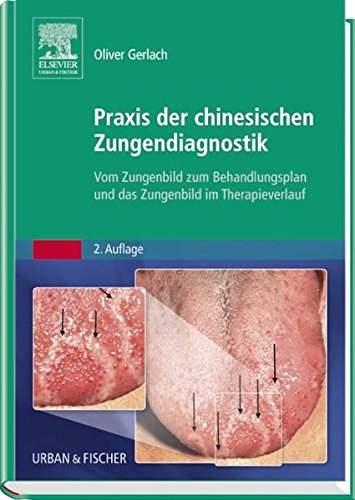 Download Praxis der chinesischen Zungendiagnostik: Vom Zungenbild zum Behandlungsplan und das Zungenbild im Therapieverlauf Download Praxis der chinesischen Zungendiagnostik: Vom Zungenbild zum Behandlungsplan und das Zungenbild im Therapieverlauf