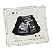 Baby Scan Diamante Photo Frame. 'A Miracle Waiting To Be Seen'. Silver Plated & Epoxy