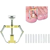 Onomo Ingrown Nail Trimmer Set, Nail Removal Apparatus and 10 Anti-Sink Rods