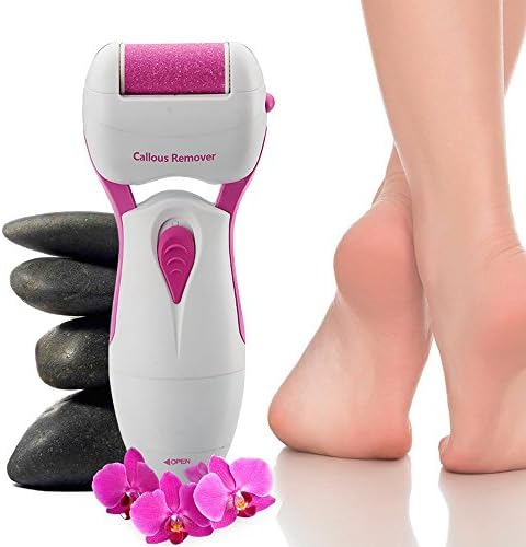 Hanmei Pedicure Hard Skin Remover Battery Operated Professional Pedicure Device With 2 Free Rollers 2AA Battery (Pink)