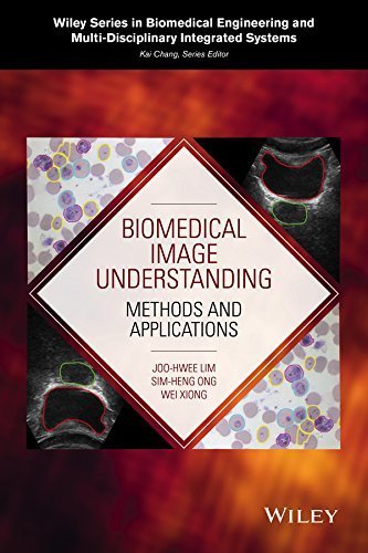 Biomedical Image Understanding: Methods and Applications (Wiley Series in Biomedical Engineering and Multi-Disciplinary Integrated Systems.) by Joo-Hwee Lim (2015-02-16)