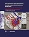 Produktbild Neurosurgery of Arteriovenous Malformations and Fistulas: A Multimodal Approach