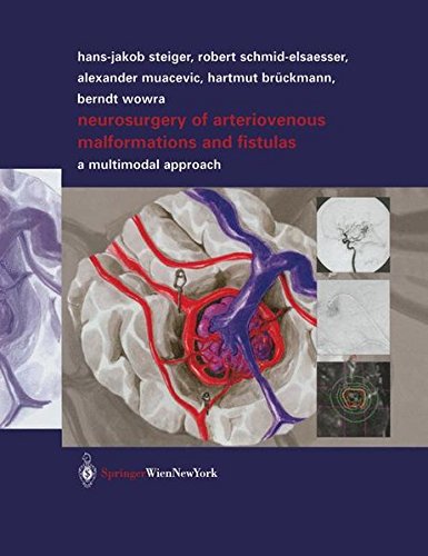Preisvergleich Produktbild Neurosurgery of Arteriovenous Malformations and Fistulas: A Multimodal Approach