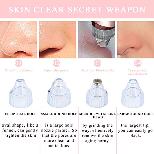 Mitesser Entferner Set, iSuri Mitesser Reiniger Elektrisch Vakuum Nase Mitesserentferner Sauger Akne Entferner Gerät Poren Reiniger mit 4 Austauschbaren Reinigungsaufsätzen (Weiß) - 2