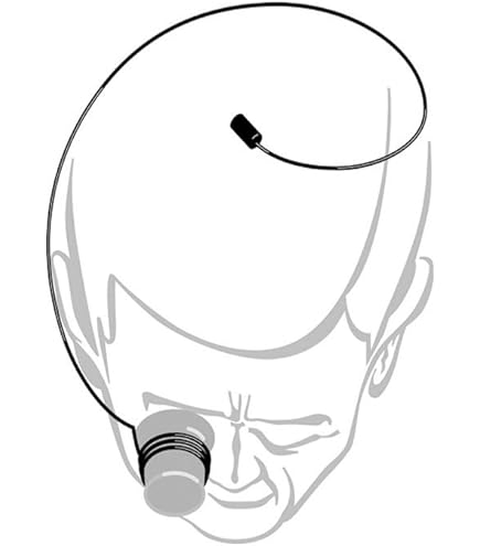 Bergeon 1458A-12 Loupe Démontable Avec 2 Lentilles Biconvexes