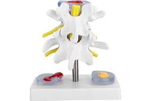 TYENAZA Anatomy Model, 3B Scientific Spine Model Anatomical Vertebrae Disc Herniation Demonstration Model, Human Medical Anatomy for Learning and Teaching