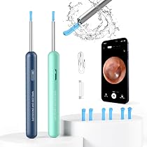Buy Beebird® Ear Cleaner Endoscope Otoscope Full HD Wireless ...