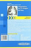 Image de Diagnóstico por la Imagen: del Tórax (Directo Al Diagnostico En Radiologia / Direct Diagnosis in Radiology)