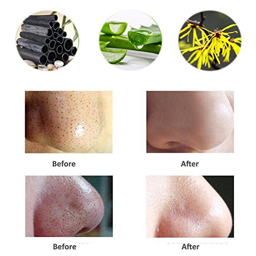 Nase Maske, Black Head Remover, Tiefenreinigung Mitesser Akne Maske Mitesser Gesichtsmaske Entfernen Mitesser Mask Aktive Bambus Kohle Formel Tearing style Deep Cleansing Purifying Peel off Acne Treatment Black Face Mask (10PC) - 4