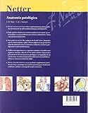 Image de Netter. anatomia patologica