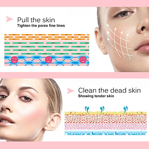 Mitesser Entferner Set, iSuri Mitesser Reiniger Elektrisch Vakuum Nase Mitesserentferner Sauger Akne Entferner Gerät Poren Reiniger mit 4 Austauschbaren Reinigungsaufsätzen (Weiß) - 5