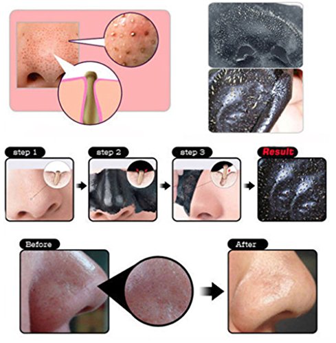 10 x Peel Off Mitesser Maske, Mitesser Entferner Maske, Gesichtsmasken Schwarz, Schwarz Maske, CIDBEST® Tiefenreinigende Blackhead Mask, Porenreiniger Maske/ schwarze Schlamm Maske, Deep Cleansing Akne Peel Off Maske, Beauty Skin Care Mitesserentferner Mask, Schönheitsmaske für Gesichtspflege - 7