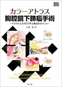 カラーアトラス胸腔鏡下肺癌手術 イラストとdvdで学ぶ術式のポイント Amazon Co Uk Books