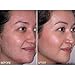 Microderm MD Skincare System with Extra 100 x Black Wool Filters