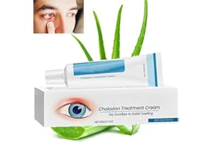 PLVNNZ Eyelid Cream For Blepharitis,Stye Eye Treatment Antibiotic Cream,Blepharitis Eye Drops,Chalazion Remover,Used for Blepharitis Treatment, Swelling, dry Eyes and Cleaning Eyelashes 20g