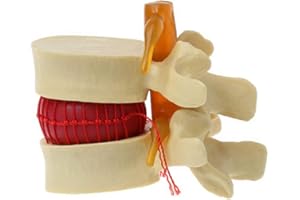 YUPVM Modèle de vertèbres lombaires colonne vertébrale anatomique hernie discale lombaire outil d'enseignement de l'anatomie modèle de vertèbres lombaires