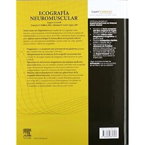 Ecografía neuromuscular