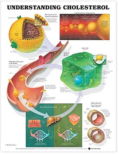 Understanding Cholesterol Anatomical Chart by Anatomical Chart Company (2000-01-28)