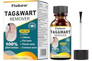 SHILEOO Skin Tag Removal Kit, Verucca Freeze Treatment, Wart Removal Liquid for Effective Wart and Verucca Removal, for All Skin Types