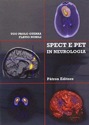 SPECT e PET in neurologia