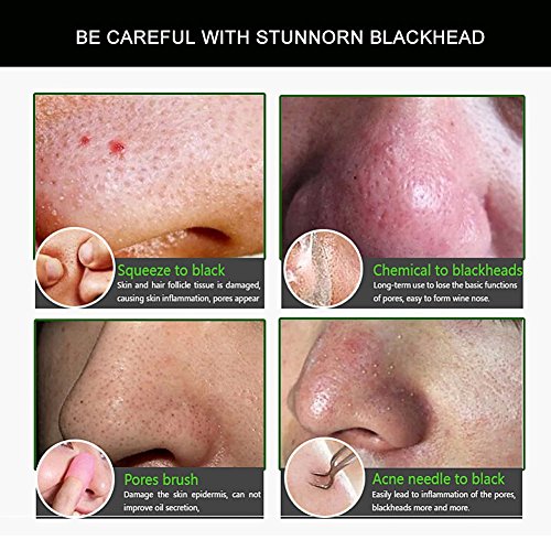 Mitesser Entferner Maske , Black Head Maske, Mitesser Maske, Gesichtsmasken Schwarz, Peel Off Maske, Bamboo Charcoal Blackhead Remover Mask CIDBEST® Suction Schwarze Maske, Black Mud Mask, Tiefenreinigung Pore Mitesser Entferner Anti Akne Öl-Kontrolle Peel off Maske, Peel Off Maske Bambuskohle Schlamm-Gesichtsmaske - 7