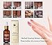 DANCINGNAIL 30ML Fungal Treatment Essence Toe Removal Nail Feet Care Serum Foot Whitening