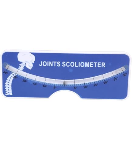 Gli Slogan Dello Xray Su Scoliosi Della Colonna Vertebrale Mostrano La Piegatura Spinale Nel Paziente Adolescente Image297986466 Gli Slogan Dello Xray Su Scoliosi Della Colonna Vertebrale Mostrano La Piegatura Spinale Nel Paziente Adolescente Image297986466