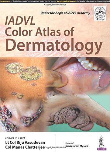 Iadvl Color Atlas of Dermatology