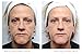 My Perfect Facial 5 Treatment Kit