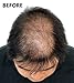 Super Million Hair - 1 x 25g Hair Building Fibres - No.23 Medium Brown