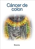 Image de Miniatlas Cáncer de colon