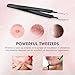 ElleSye Blackhead Remover, 5 + 1 Spot Remover Kit, Comedone Pimple Extractor, Blemish Acne Treatment Tool with Curved Tweezer, Stainless Steel Handle and Silver Metal Case