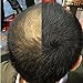 LDN Professional Hair Building Fibres for Hair Loss and Thin Hair, No.1 for Instantly Thickening Hair Naturally, 22g hair fiber bottle