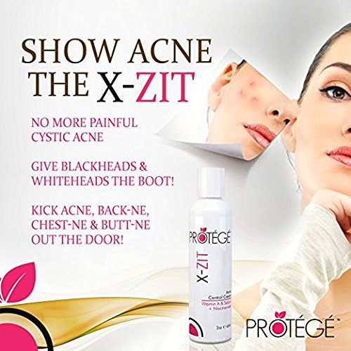 Natürliche Aknebehandlungscreme – X-ZIT – X Out Akne Behandlung für Erwachsene und Teenager + Bekommen Sie ein reines Gesicht + Kontrollieren Sie Pickelbildung auf natürliche Art mit dieser Akne Creme (60 ml) - 7