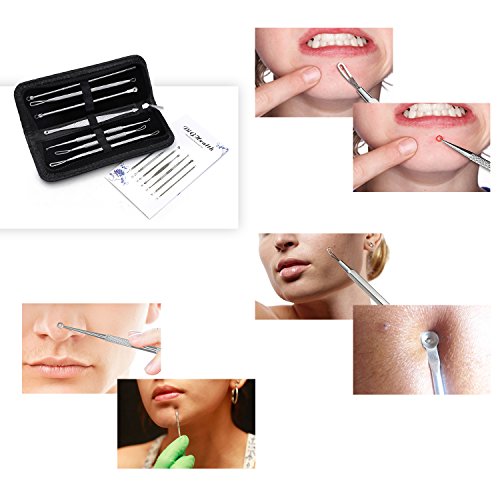 7 Stücke Mitesserentferner DigHealth, Komedonenquetscher Edelstahl Doppelseitig, Weiße Mitesser Löffel Extraktor, Pickel und Akne Ausdrücker, Komedonenheber für Nase Gesicht Haut Behandlung Hausmittel - 9