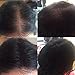 LDN Professional Hair Building Fibres for Hair Loss and Thin Hair, No.1 for Instantly Thickening Hair Naturally, 22g hair fiber bottle