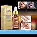 DANCINGNAIL 30ML Fungal Treatment Essence Toe Removal Nail Feet Care Serum Foot Whitening