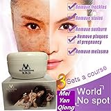 Fashladyâ„¢ New Bright Skin Cream Freckles Sunburn Plaques Of Pregnancy Remove Face Brighten Magic Glow Freckle Removal Whitening Cream
