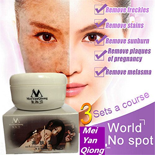 Fashladyâ„¢ New Bright Skin Cream Freckles Sunburn Plaques Of Pregnancy Remove Face Brighten Magic Glow Freckle Removal Whitening Cream
