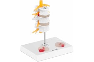 PHYSA WELLNESS & LIFESTYLE Physa Maquette Modèle Anatomique Des Disques Intervertébraux L1 L2 L3 L4 L5 Anatomie Colonne Vertébrale PHY-SM-6 (Hernie Discale Lombaire, Couleurs, Très Riche En Détails, Sur Base, Plastique)