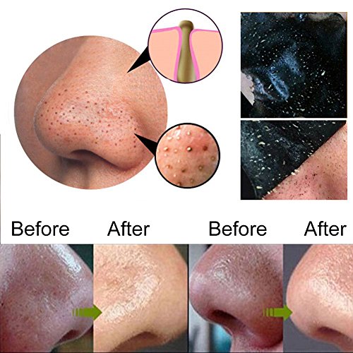 Black Head Maske, Peel off Maske, Mitesser Maske, Mitesser Gesichtsmaske, Gesichtsmasken Schwarz Black Mask, Blackhead Remover Mask, Black Mud Mask Mitesser, Tiefenreinigung Entferner Pore Acne Purifying Black Head, Beauty Skin Care Mitesserentferner Mask (60g) - 4