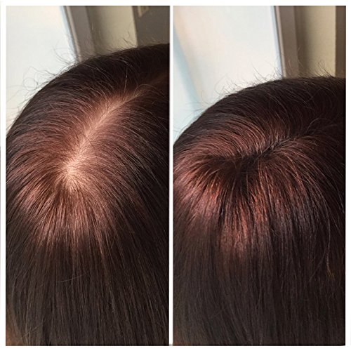 -26g- IMPERIO STREUHAAR zur HAARVERDICHTUNG & VOLLEM HAAR in Sekunden. SCHÜTTHAAR-100% Natur! (DUNKELBRAUN) - 3