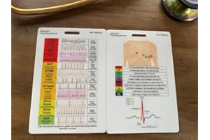 TMG CARDS ECG Reference Card for Healthcare Professionals and Students. ECG Rhythm Guide, ECG Lead Placement. ECG, EKG, Electrocardiogram. 10 x 7 cm.