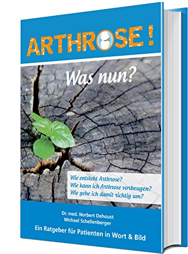 Preisvergleich Produktbild Arthrose! Was nun
